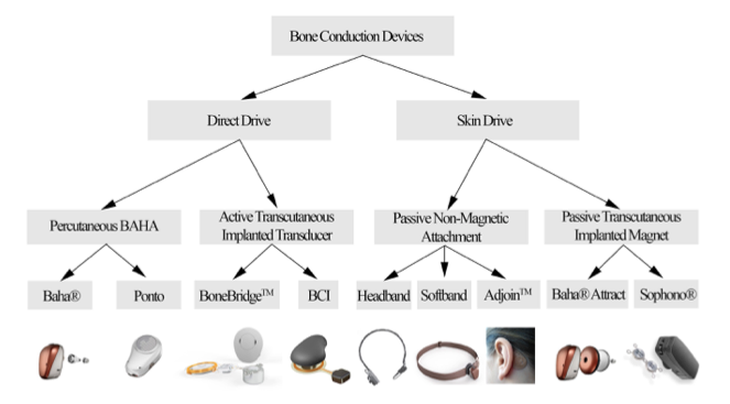 Articles Archives - Audioscan